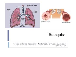 bronquite.pptx